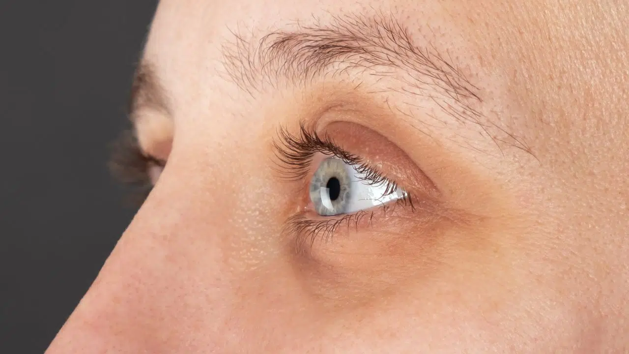 Journée mondiale du Kératocône le 10 novembre 2023 Journée mondiale du Kératocône le 10 novembre 2023