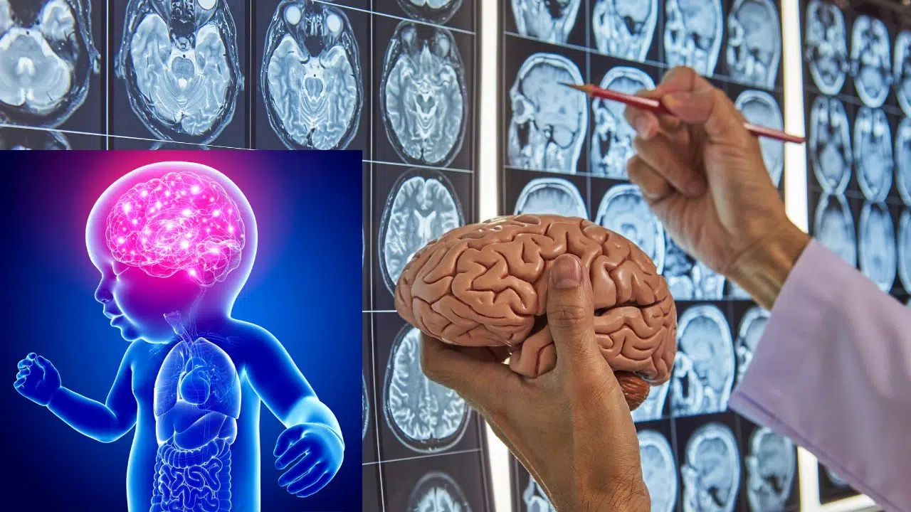 Grosses inquiétudes : Le climat influence-t-il la taille de notre cerveau ? Quelles sont les dernières découvertes Grosses inquiétudes : Le climat influence-t-il la taille de notre cerveau ? Quelles sont les dernières découvertes