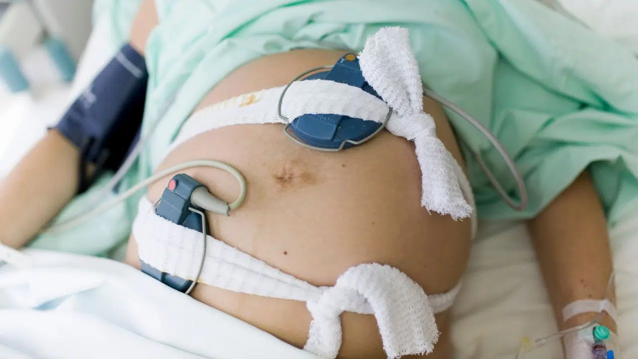 Les conséquences oubliées de l'accouchement Une étude approfondie sur les impacts à moyen et long terme Les conséquences oubliées de l'accouchement Une étude approfondie sur les impacts à moyen et long terme