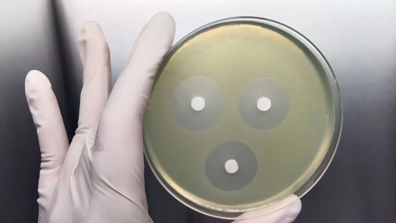 Découverte d'une nouvelle classe antibiotiques grâce à l'IA Découverte d'une nouvelle classe antibiotiques grâce à l'IA