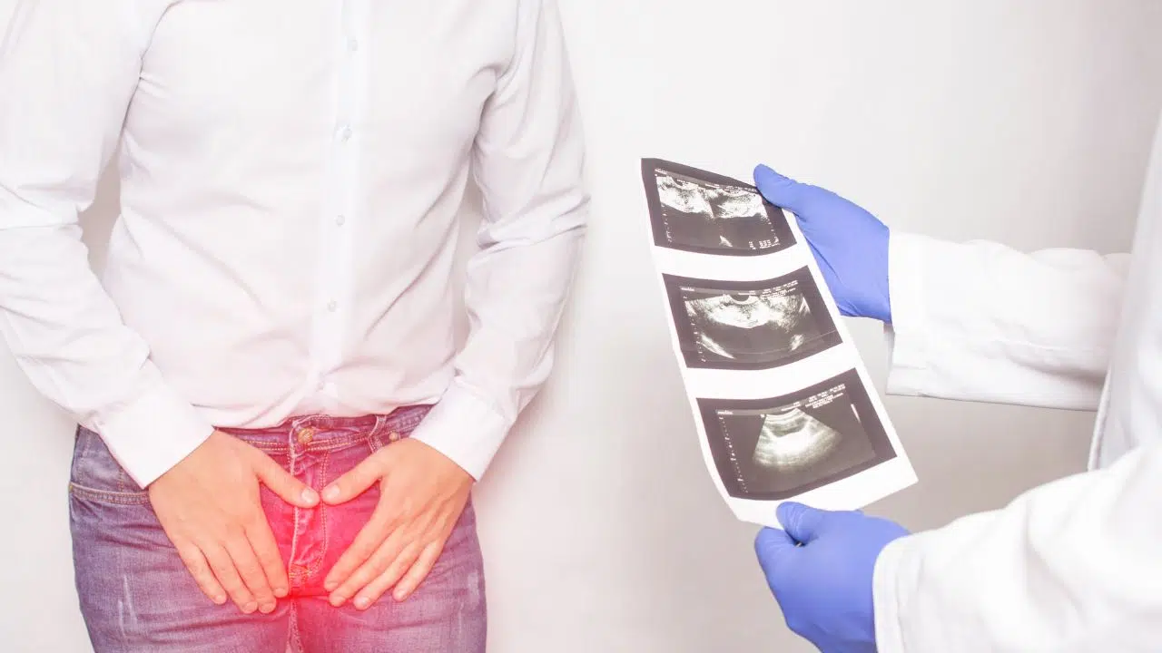 Révolution dans le traitement de l’hypertrophie de la prostate avec de la vapeur d'eau ! Révolution dans le traitement de l’hypertrophie de la prostate avec de la vapeur d'eau !