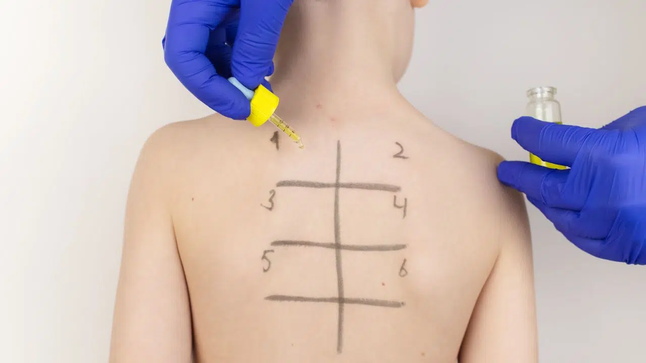 Journée Nationale de l'Hypersensibilité Journée Nationale de l'Hypersensibilité