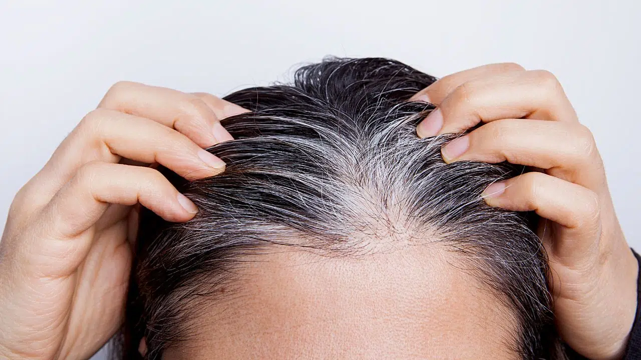 On sait enfin pourquoi les cheveux deviennent blancs. Une étude explique comment rajeunir vos cellules On sait enfin pourquoi les cheveux deviennent blancs. Une étude explique comment rajeunir vos cellules