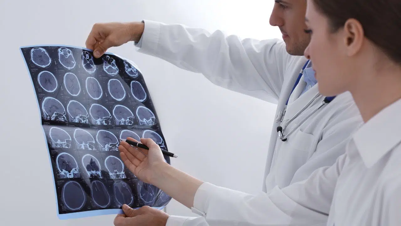 Journée mondiale de la sclérose en plaques le 30 mai 2024 Journée mondiale de la sclérose en plaques le 30 mai 2024