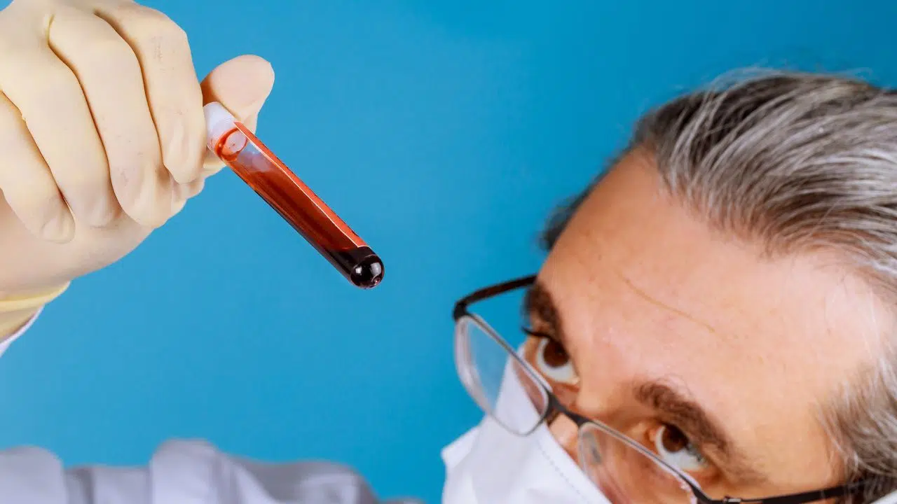 Semaine nationale de sensibilisation à l'hémochromatose le 1 juin 2024 Semaine nationale de sensibilisation à l'hémochromatose le 1 juin 2024