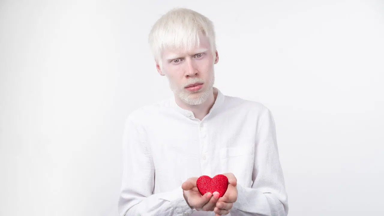 Journée internationale de sensibilisation à l'albinisme le 13 juin 2024 Journée internationale de sensibilisation à l'albinisme le 13 juin 2024