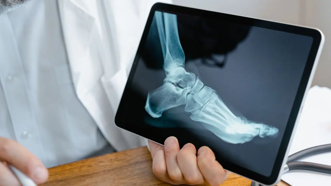 Journée nationale de la santé du pied le 15 juin 2024 Journée nationale de la santé du pied le 15 juin 2024