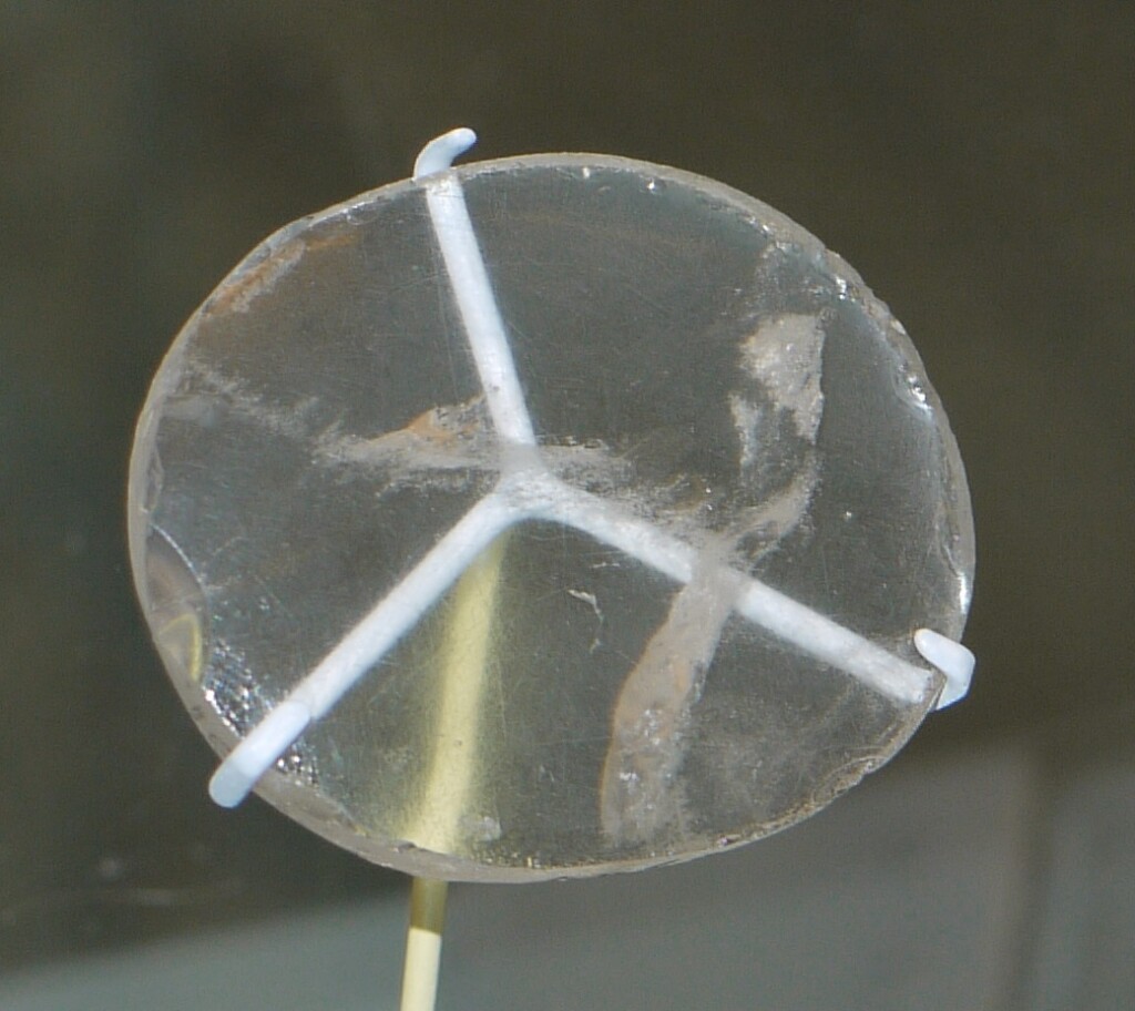 La lentille de Nimrud servait-elle aux myopes qui vivaient en 750 avant JC pour mieux voir ?