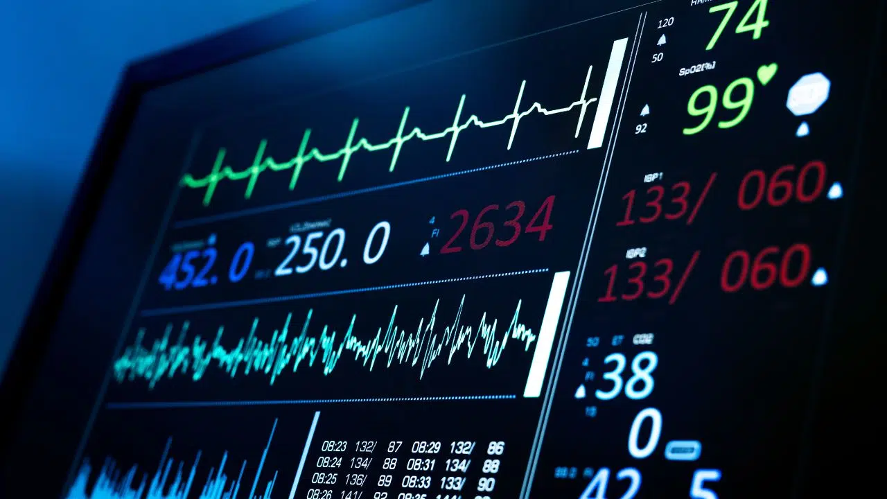 L’intelligence artificielle détecte 14 fois mieux les arythmies sévères que les humains L’intelligence artificielle détecte 14 fois mieux les arythmies sévères que les humains